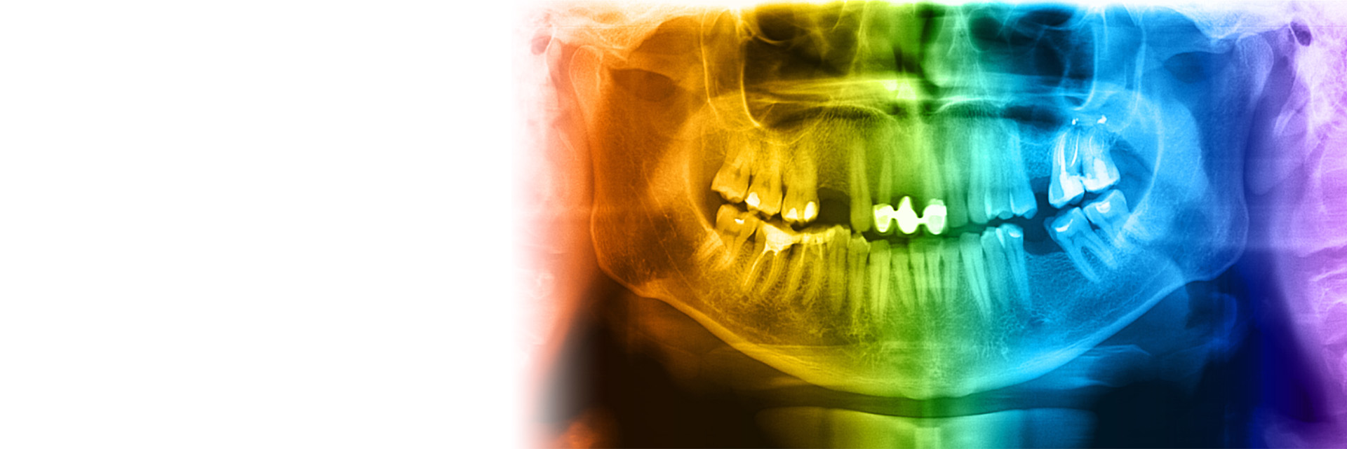 Dental imaging